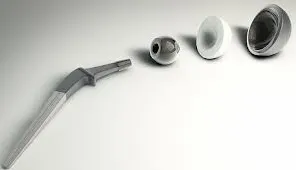 Эндопротезирование